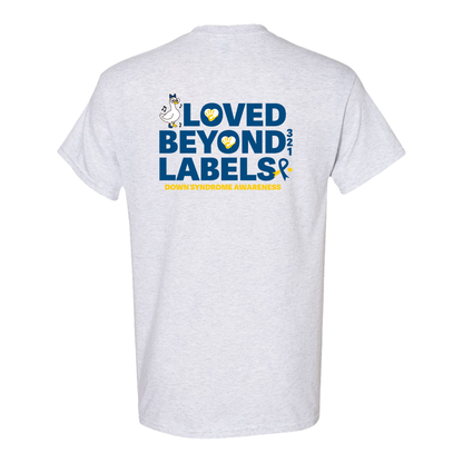 Loved Beyond Labels